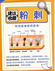 -苗方清颜痘肌研究所