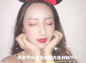 植发的密度与哪些方面有关？