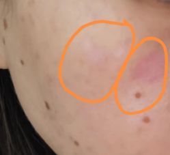 -东剑医学美容·注射美学中心