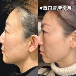 -上海伊莱美医疗美容医院