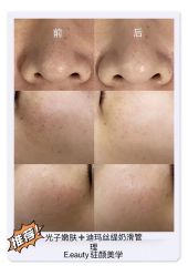 -E.beauty驻颜·痘敏肌调理中心