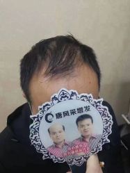 -唐风采假发补发定制