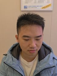 -大麦微针植发全国连锁