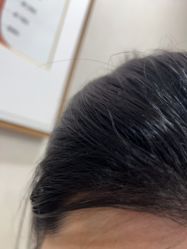 -熙朵美学植发·连锁品牌