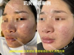 -元熙兰积皮肤管理