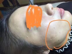 -清疣美疣·痣·斑净肤中心