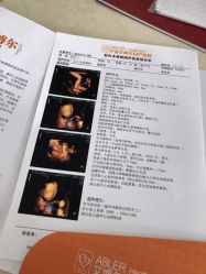-艾博尔医院