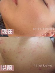 -美肤盾祛痘·问题肌头疗管理中心