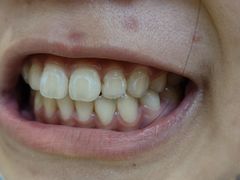 -同步齿科·数字化正畸种植口腔中心(珠海店)