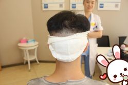 点击看大图 -大麦微针植发丨全国连锁