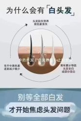 -舒欣头疗·俏丝谧语 白发脱发专业护理 