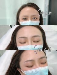 -久匠半永久纹眉