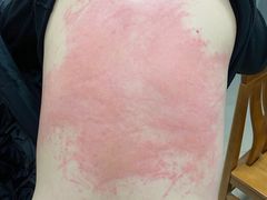 -无锡市第二人民医院(南院)