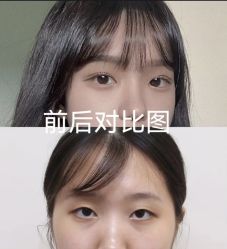-素美医疗美容·西南眼鼻整形·修复基地