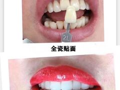 -团圆口腔·种植中心(锦江院区)