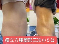 -瘦立方身材管理中心