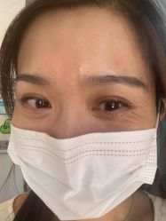 -小忠丽格医美