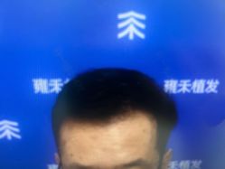 -雍禾植发全国连锁