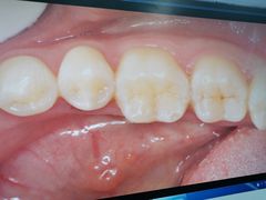 -深圳佑诺口腔门诊部