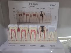 -上海仁爱医院口腔科 · 种植