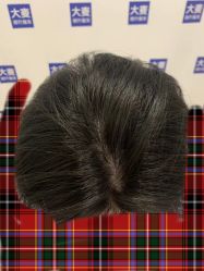 -大麦微针植发丨全国连锁