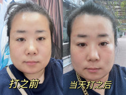 -媛音医美