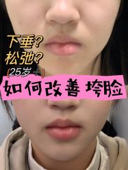 -上海伊莱美医疗美容医院