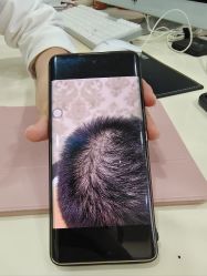 -新生植发·植养护一体