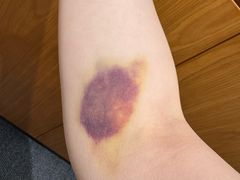 -瑞慈体检上海徐汇机构