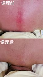 -西宁时光月子中心