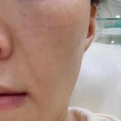 体验后-深圳阳光医疗美容医院·旗舰店