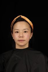 体验后-烟台曙光医疗美容医院