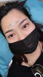 -郡艺医疗美容·微整·眼鼻吸脂