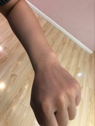 -晶奕空间专业脱毛连锁机构