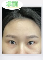 -素美医疗美容·西南眼鼻整形·修复基地