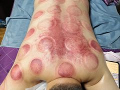 -沈师傅盲人按摩工作室(密三小区店)