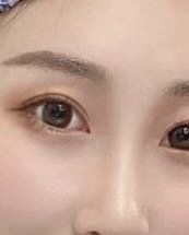 -莲姿娜·半永久纹眉皮肤管理