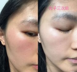 -春田皮肤管理中心品牌旗舰店