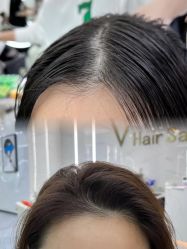 -V+ Hair