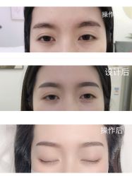 -久匠半永久纹眉