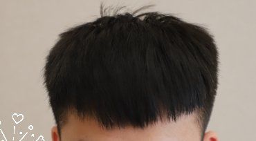 -大麦微针植发丨全国连锁