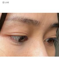 -上海伊莱美医疗美容医院