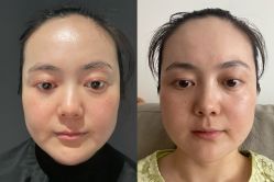 体验后-BR光电保养