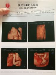 -重庆五洲妇儿医院·妇幼保健