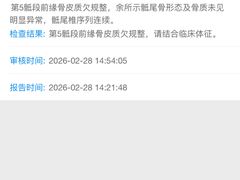 -meland·儿童乐园·游戏厅娃娃机·电玩Xbox(成都合生汇店)