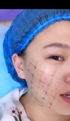体验前-大连美天医疗美容医院