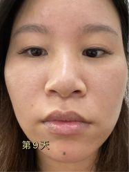 -Yestar宁波艺星整形医院