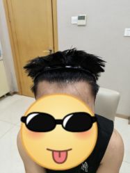 -大麦微针植发丨全国连锁