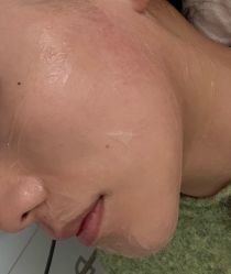 -长沙雅美医疗美容医院