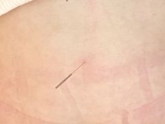 -上海市中医医院(石门路院区)